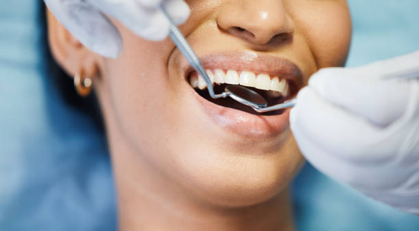 Best Weekend Emergency Dentist in Fircrest, WA