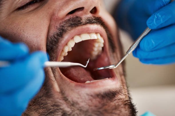 Best Urgent Dental Care for Toothache in Fircrest, WA