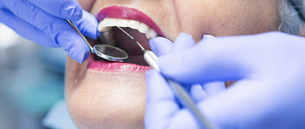Best Emergency Dentist for Knocked-Out Tooth in Fircrest, WA